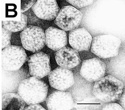 Electron micrograph of isolated carboxysomes. Scale bar = 100 nm. [Source](https://commons.wikimedia.org/wiki/File:Carboxysomes_EM.jpg): doi:10.1371/journal.pbio.0050144