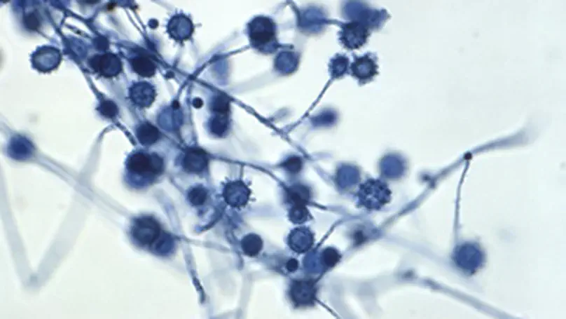 Invasive Fungal Infections: A Creeping Public Health Threat