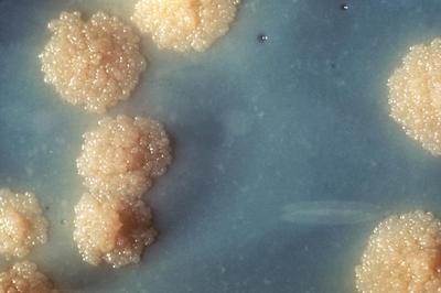 Figure 1. Colonies of _Mycobacterium tuberculosis_ on an agar plate appear cream-colored and rough. [Source](https://commons.wikimedia.org/wiki/File:TB_Culture.jpg)