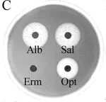 Siderophores: A treatment target?