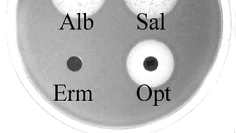 Siderophores: A treatment target?